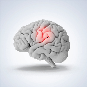 Understanding The Various Brain Tumor Causes 